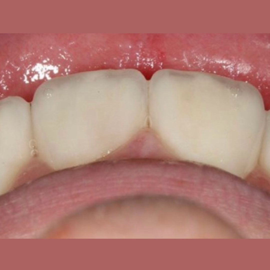 Después Victoria V.