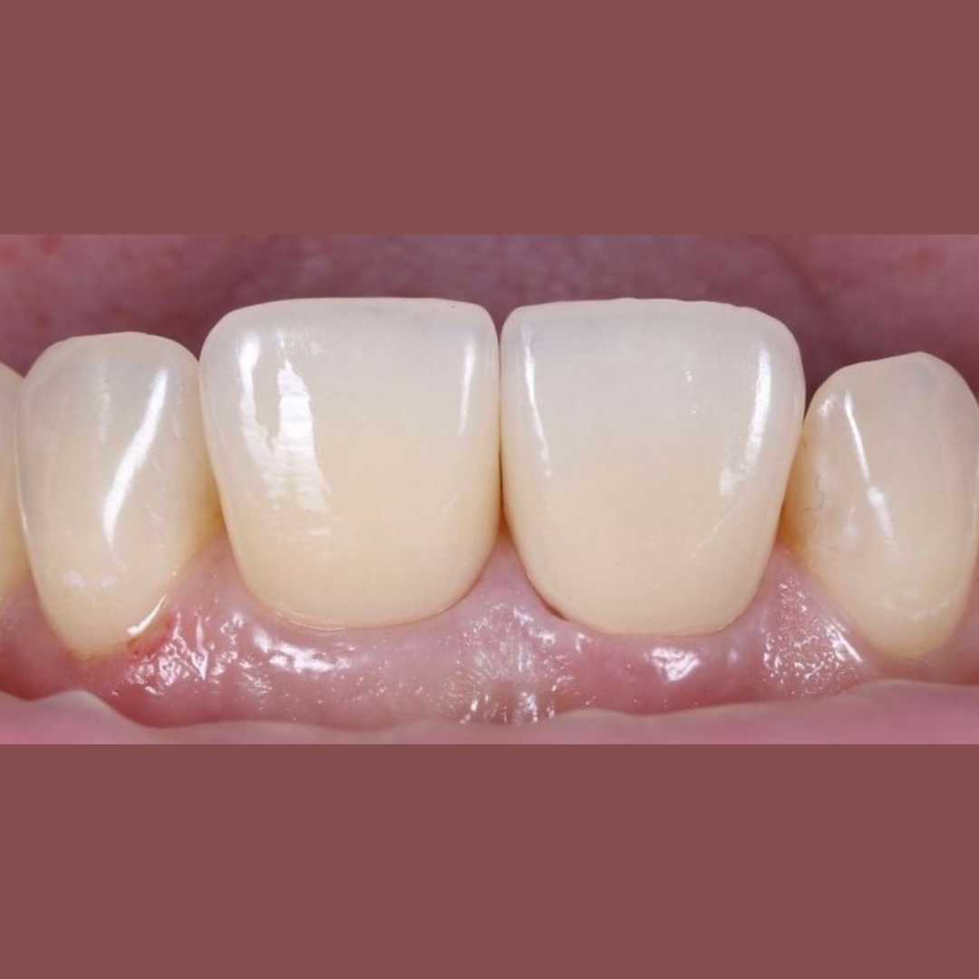 Después Cristóbal C.